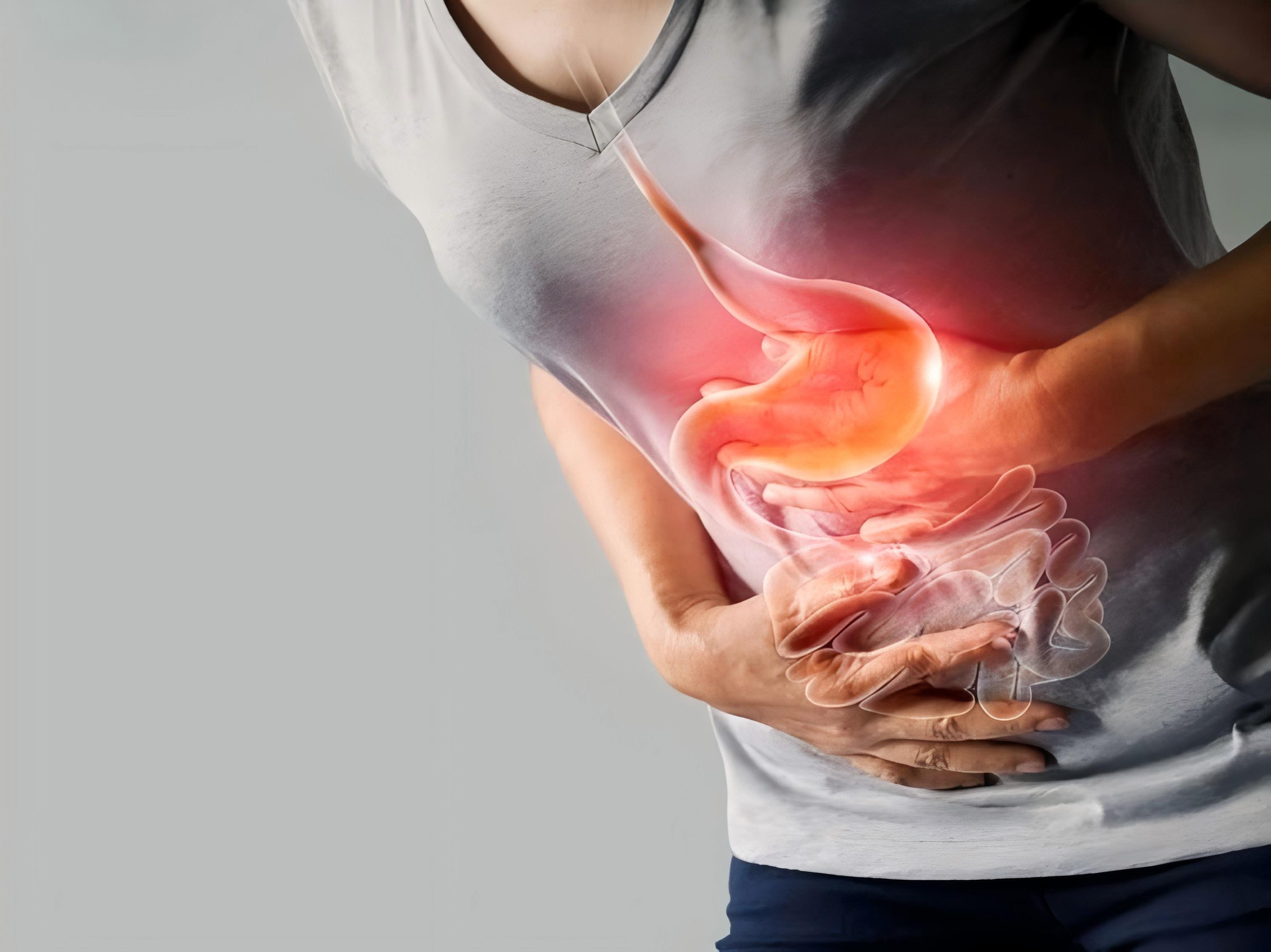 Person holding their stomach, illustration of the digestive tract overlaid to show the area affected by acid burns
